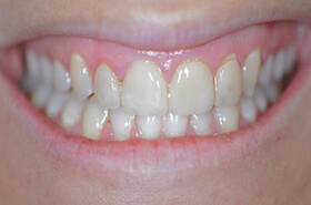 Cosmetic Dentistry Before