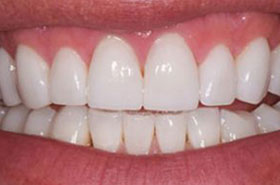 smile-images