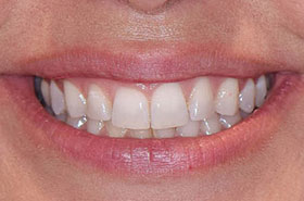 smile-images