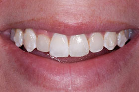 smile-images