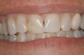 smile-images