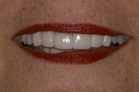 smile-images