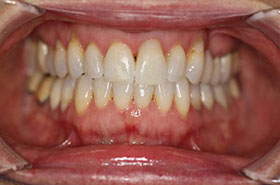 smile-images