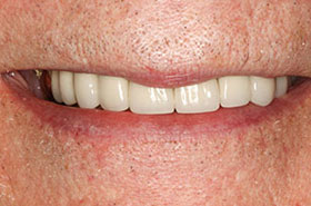 smile-images