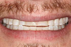 smile-images