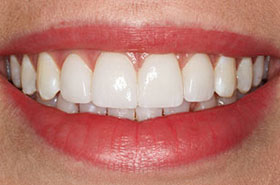 smile-images