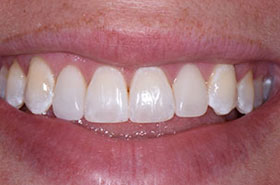 smile-images