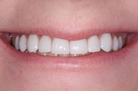 smile-images