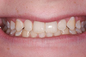 smile-images