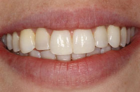 smile-images
