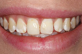 smile-images
