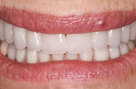 smile-images