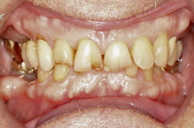 smile-images