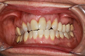 smile-images