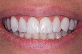 smile-images