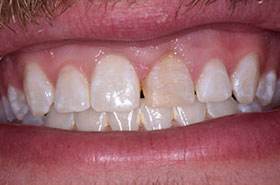 smile-images