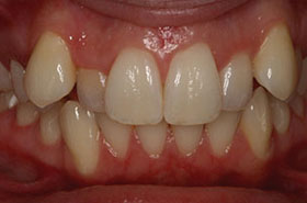 smile-images