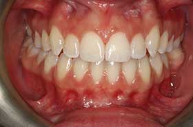 smile-images