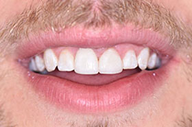 smile-images