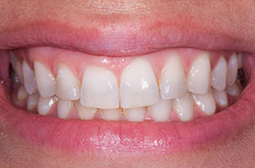 smile-images