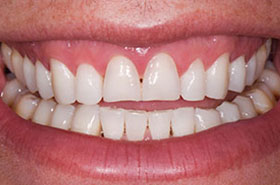 smile-images