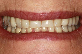 smile-images