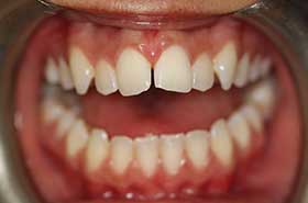 smile-images