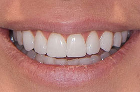 smile-images
