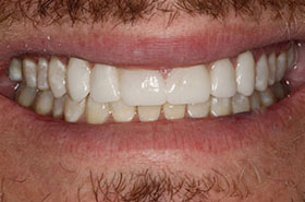 smile-images