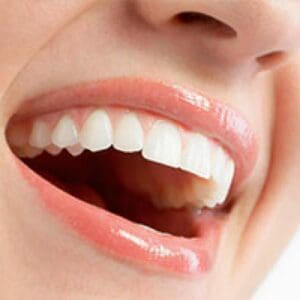 Get a Great Deal on a Dental Exam