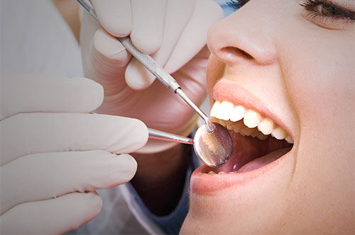 Close-up of dental checkup showing dentist examining patient's teeth with dental mirror and probe