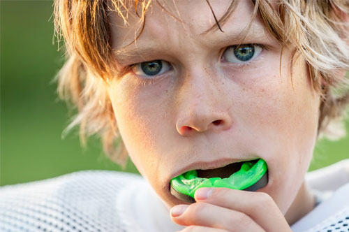 Mouthguards 1 at Van Buskirk & Krischke DDS, LLC in Crown Point, IN