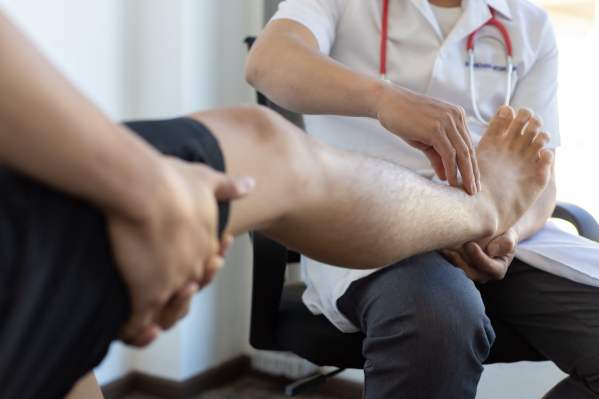 How to Relieve Painful Varicose Veins - Beltline Health