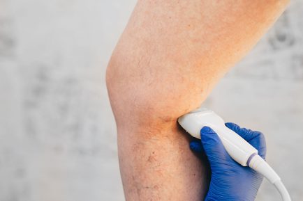 what causes venous insufficiency - Beltline Health
