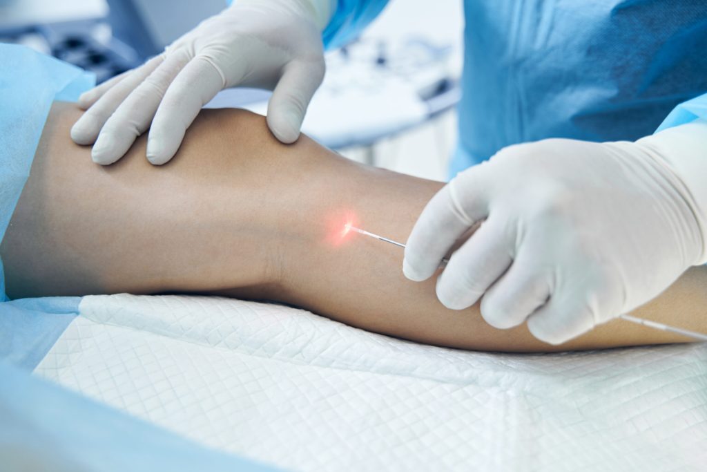 Healthy Veins - Dr. Procter
