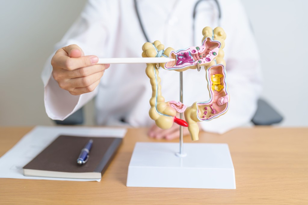 Doctor with human Colon anatomy model