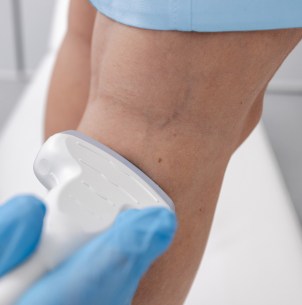 Minimally invasive vein treatments