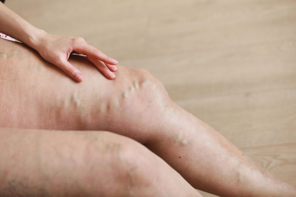 Health Vein - Beltline Health & Weight Loss Solutions