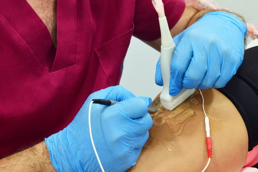 Reversing Venous Insufficiency - Beltline Health & Weight Loss Solutions