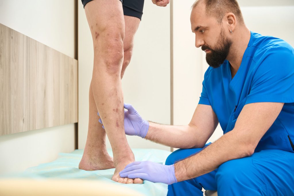 Venous Insufficiency Lead to Ulcers Beltline Health