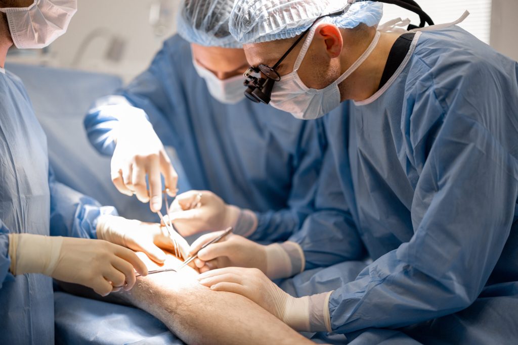 Surgical Treatment for Varicose Veins