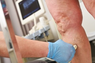 Vein Ultrasound