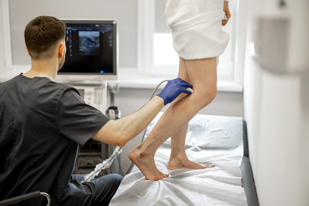 Radiofrequency Ablation of Varicose Vein