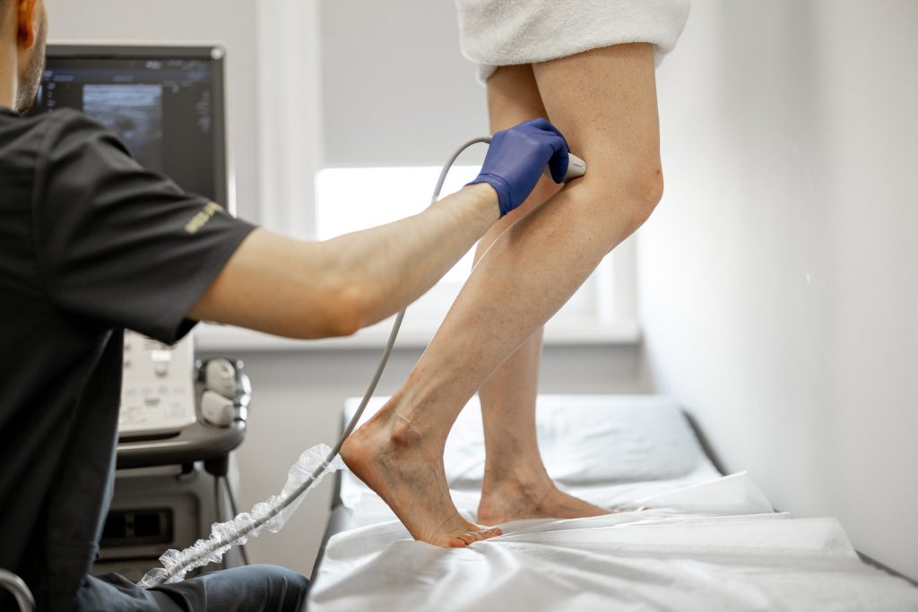 vein ablation