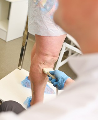 Vein ultrasound procedure