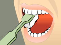 Illustration of a person cleaning their tongue with a green tongue scraper inside an open mouth.