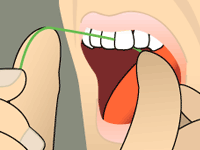 Close-up illustration of a person flossing teeth with green dental floss for oral hygiene.