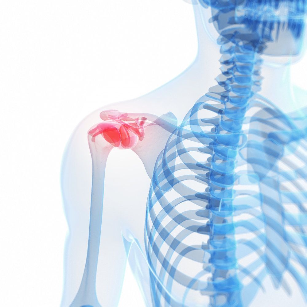 An issue with the shoulder joint and rotator cuff