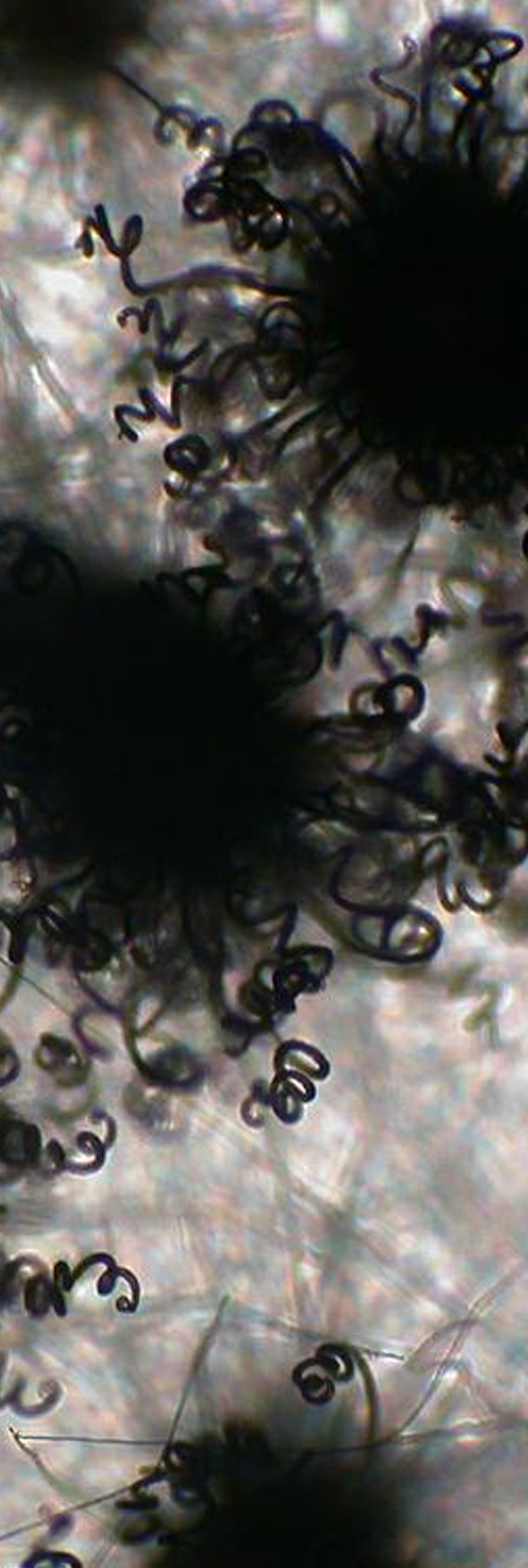 ERMI Testing for Mold - What is it and do you need it?