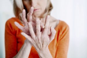 osteoarthritis and rheumatoid arthritis